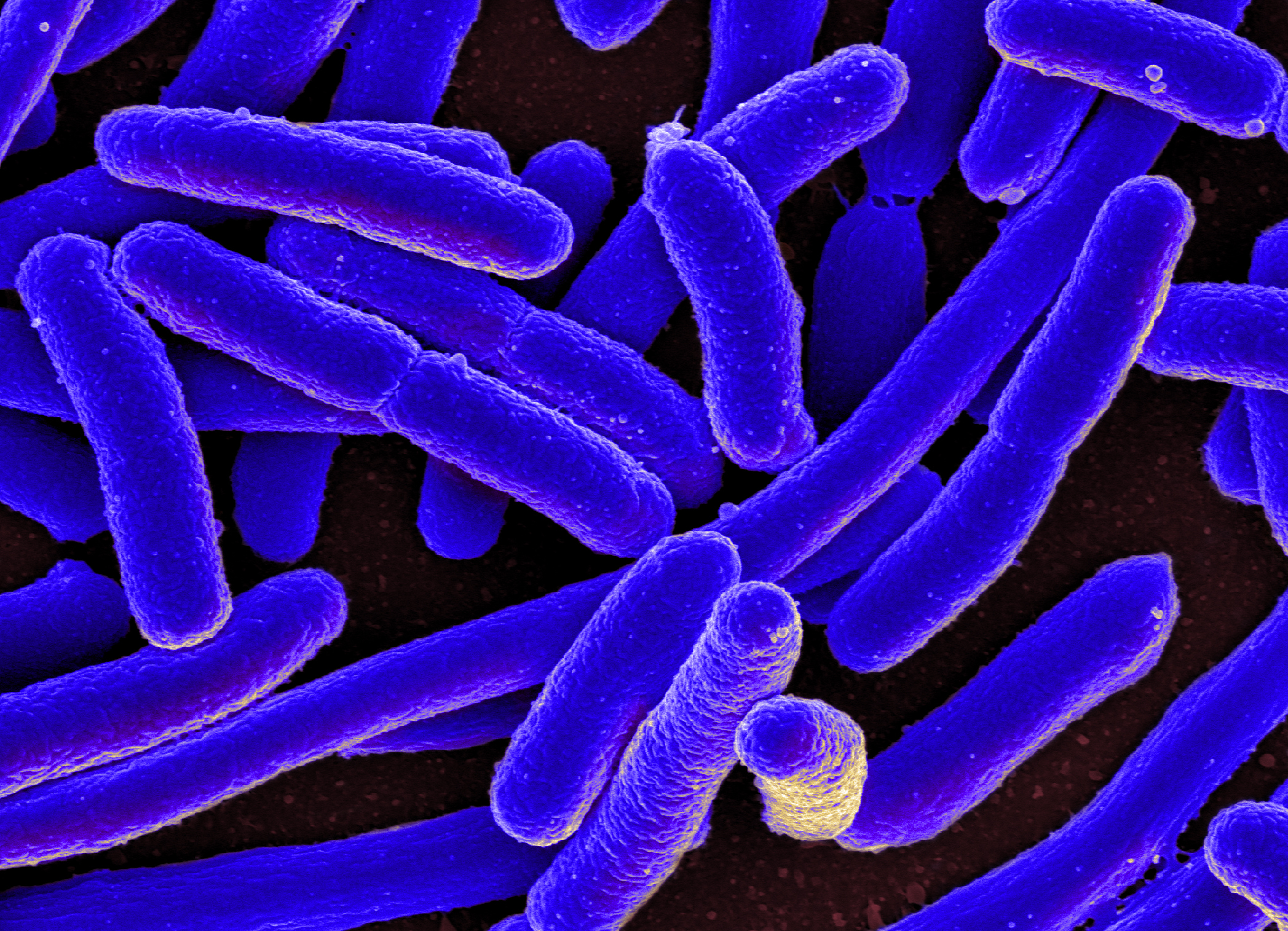 E_coli